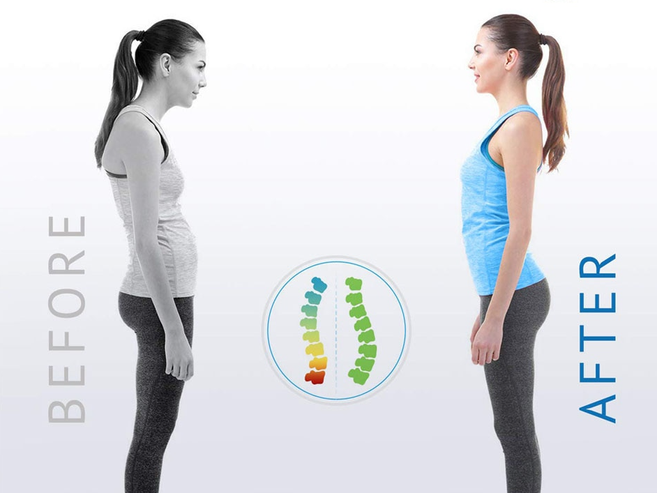 Adjustable Posture Corrector – Back & Shoulder Support